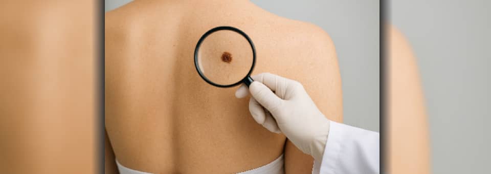 1-Fleck-Sprechstunde